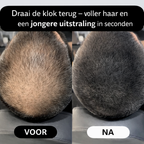 THICKR - Haarlijn Poeder